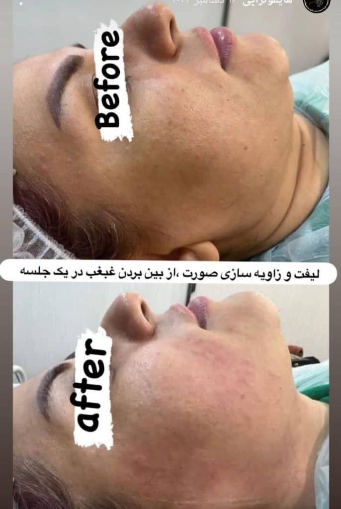 کلینیک لاغری گلدن فیس در خوی