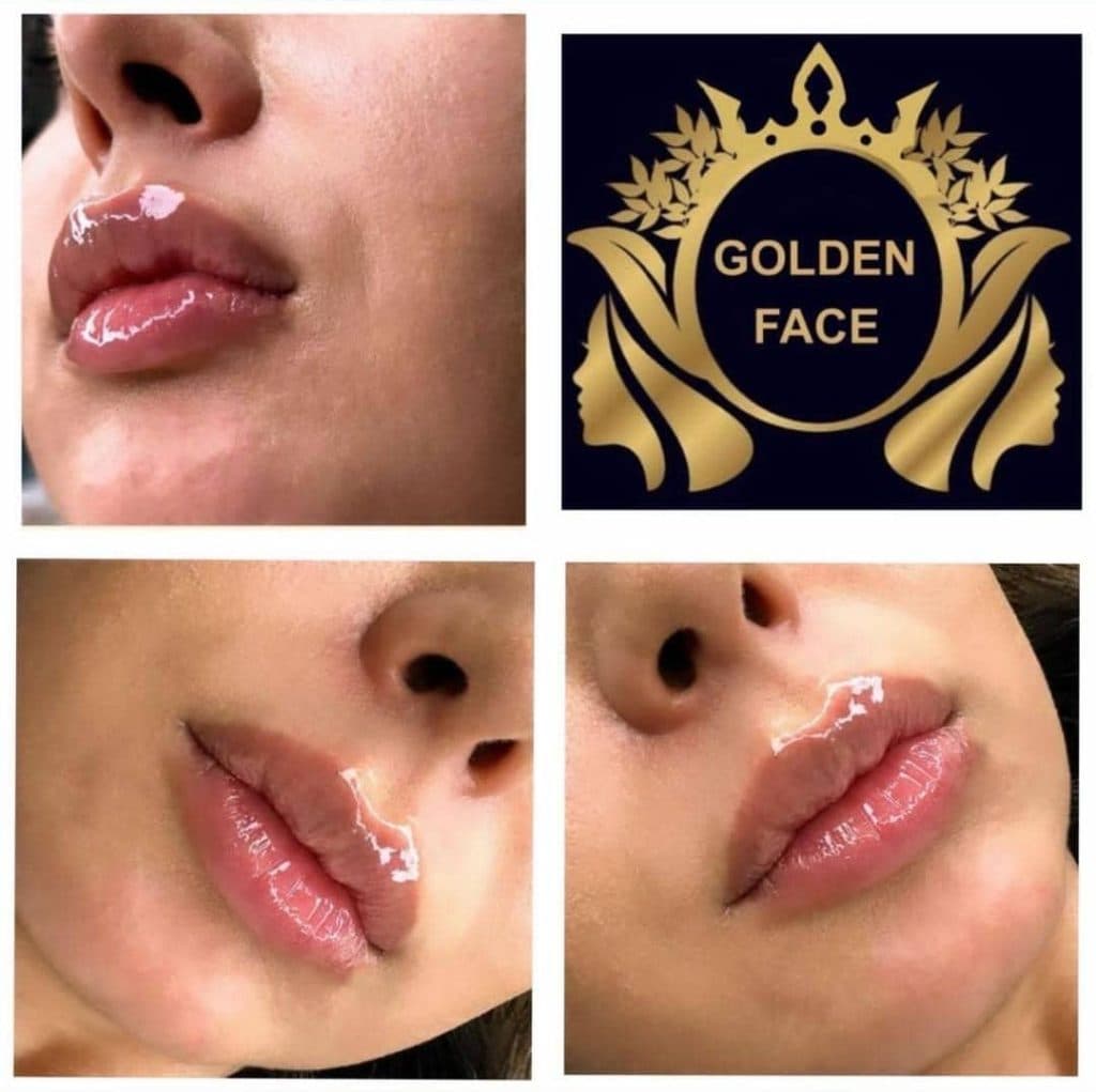 کلینیک لاغری گلدن فیس در خوی