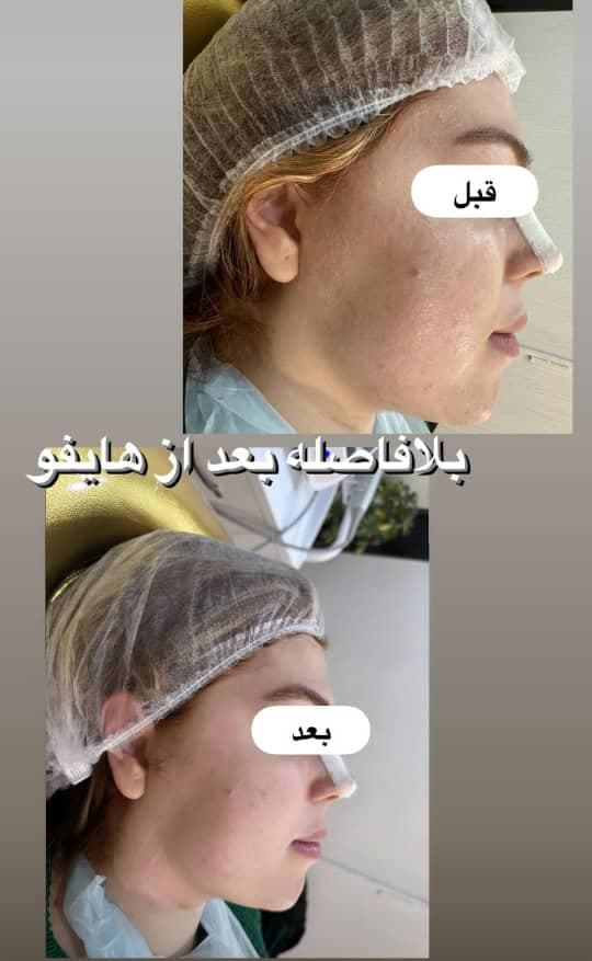 کلینیک لاغری گلدن فیس در خوی