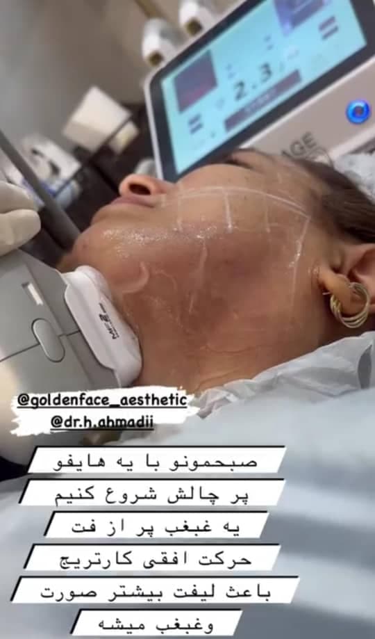 کلینیک لاغری گلدن فیس در خوی