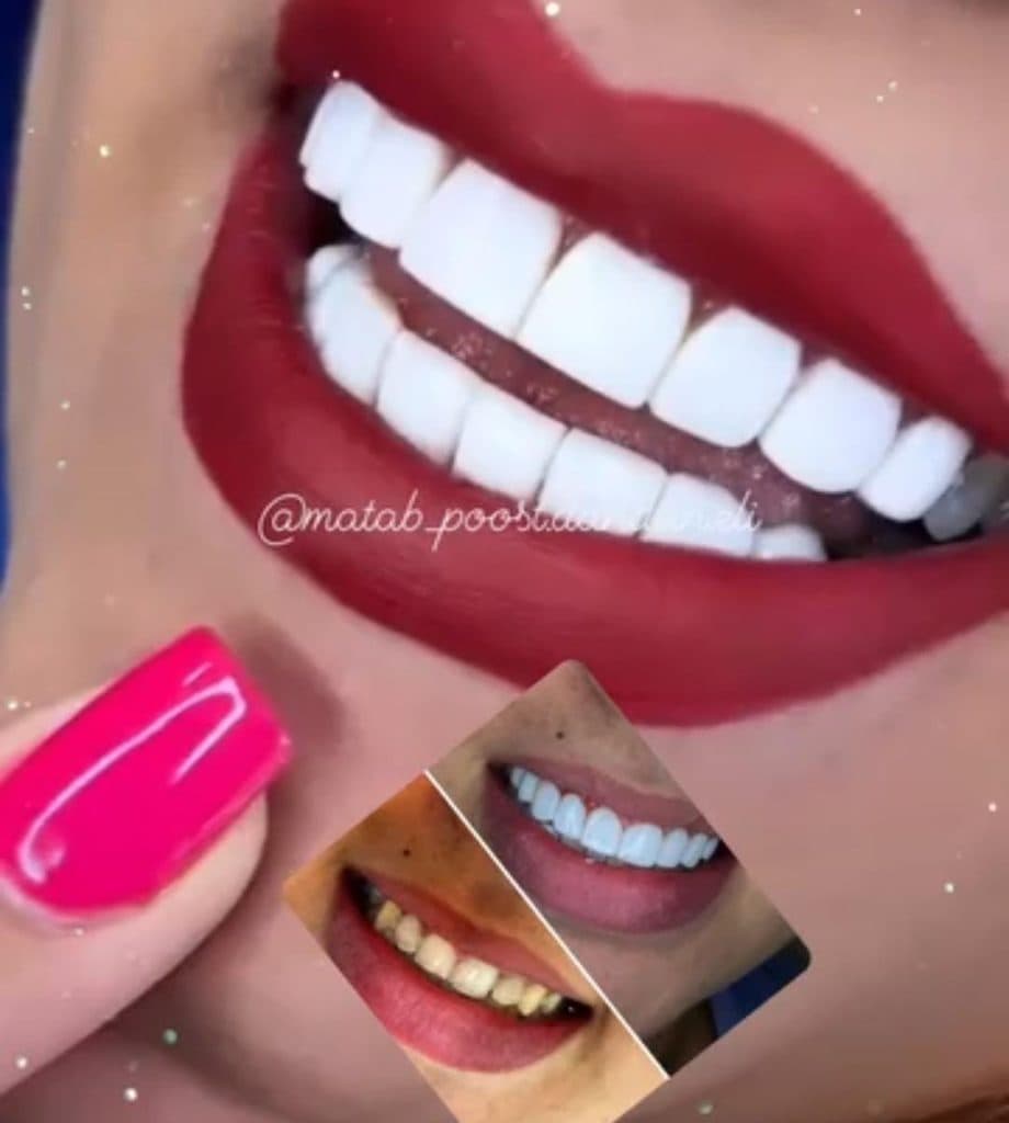 کلینیک تخصصی دندانپزشکی الی خسروانی در تهرانپارس تهران