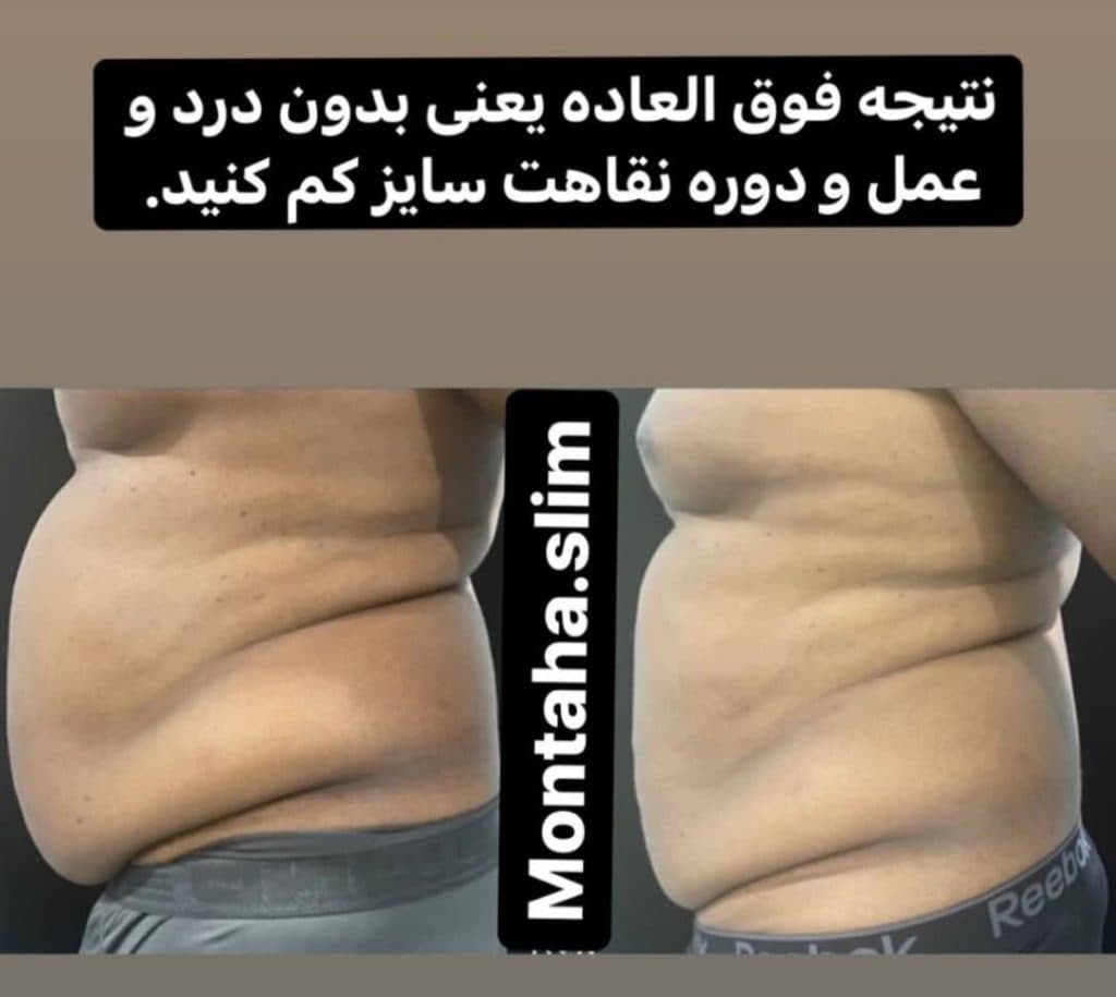 کلینیک لاغری زیبایی منتها در کیانپارس اهواز