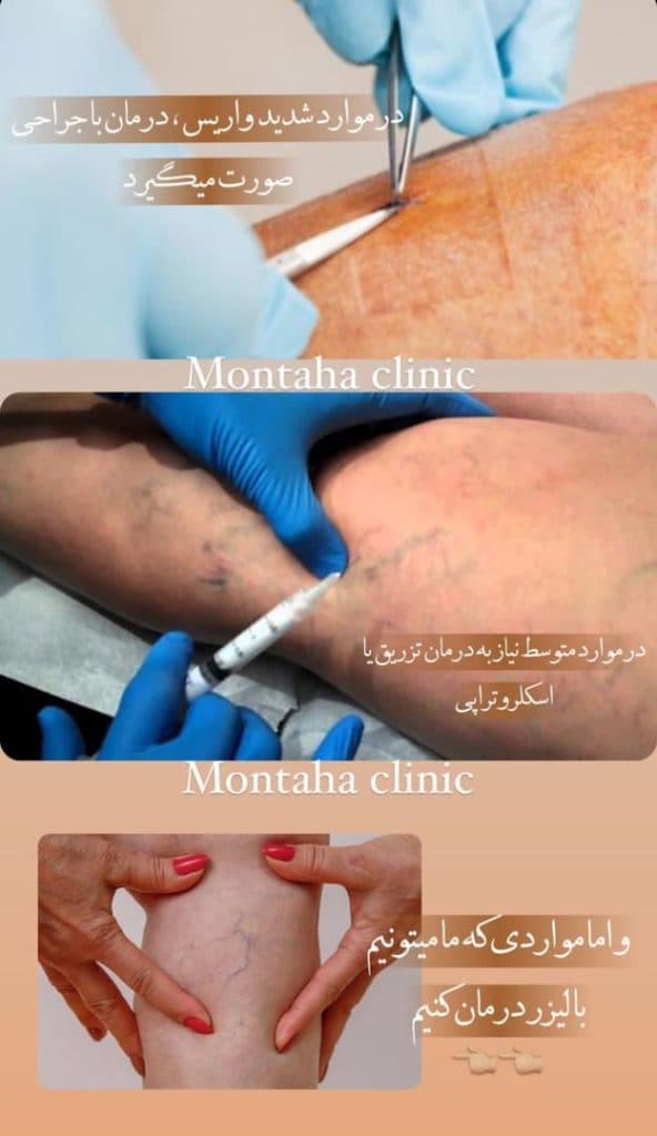 کلینیک لاغری زیبایی منتها در کیانپارس اهواز