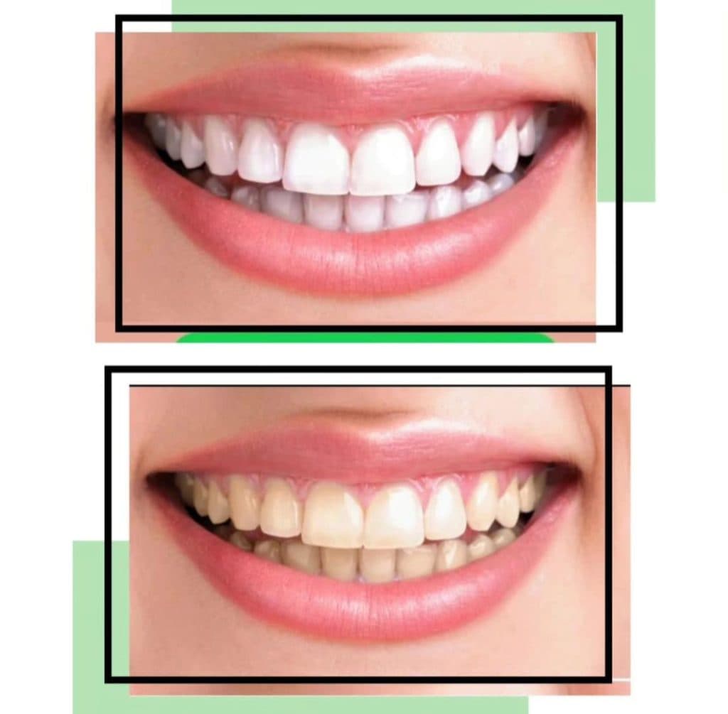 کلینیک دندانپزشکی درسا در مطهری خرم آباد