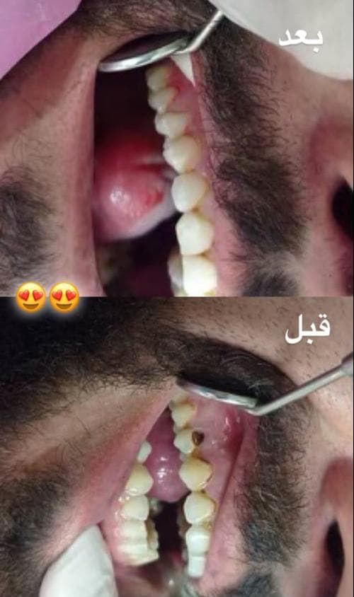 مطب دندانپزشکی دکتر نصر در اباذر کاشان