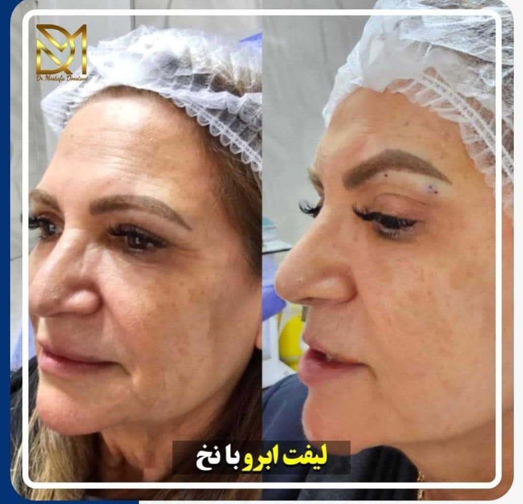 مطب دکتر مصطفی دوستانی جراح و متخصص پوست مو و زیبایی در تبریز