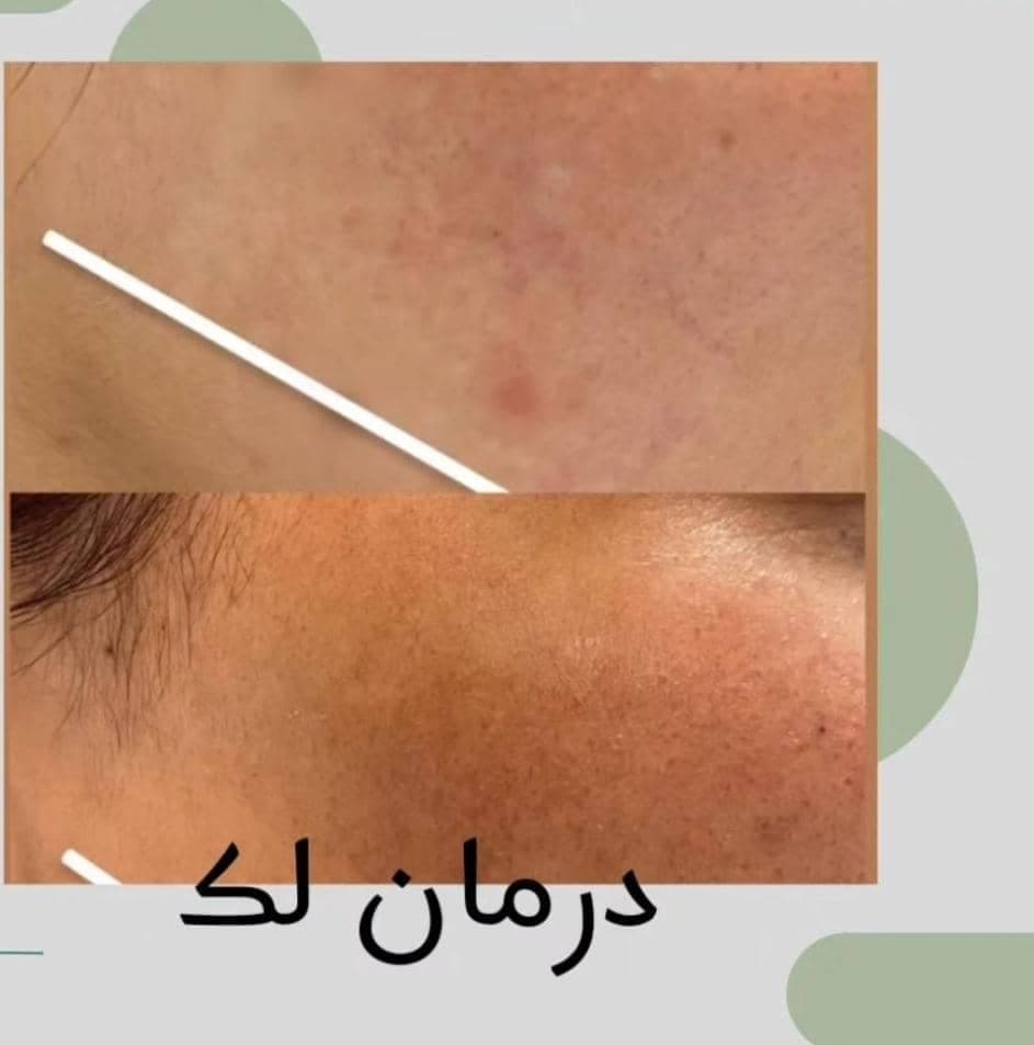مرکز زیبایی پوست لارن در تهران