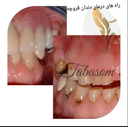 درمانگاه دندانپزشکی تبسم رویایی در بلوار جانباز یزد