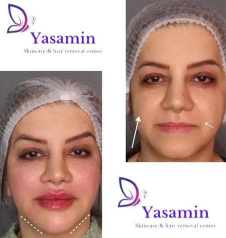 کلینیک تخصصی زیبایی پوست و مو یاسمین در فردوسی شاهین شهر