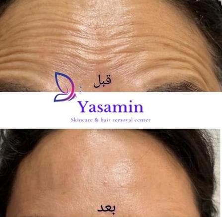 کلینیک تخصصی زیبایی پوست و مو یاسمین در فردوسی شاهین شهر