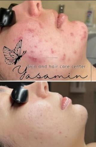 کلینیک تخصصی زیبایی پوست و مو یاسمین در فردوسی شاهین شهر