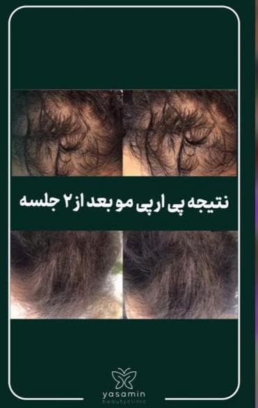 کلینیک تخصصی زیبایی پوست و مو یاسمین در فردوسی شاهین شهر