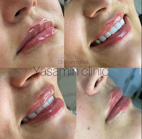 کلینیک تخصصی زیبایی پوست و مو یاسمین در فردوسی شاهین شهر