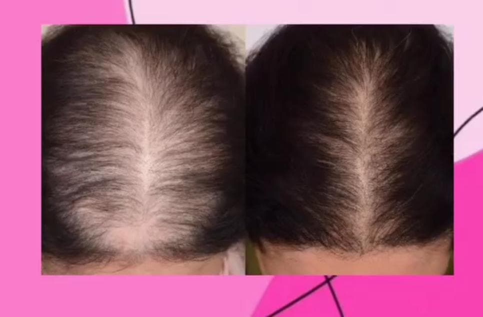 کلینیک تخصصی زیبایی نور در آزادی کرمانشاه
