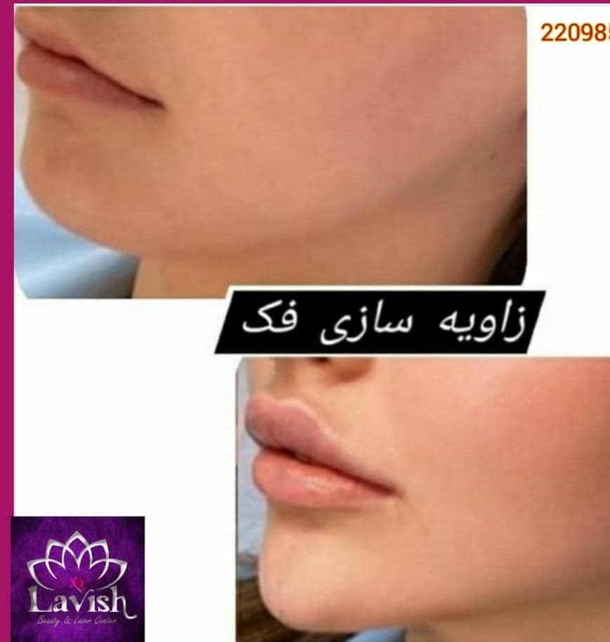 مرکز تخصصی زیبایی لاویش در سعادت آباد تهران