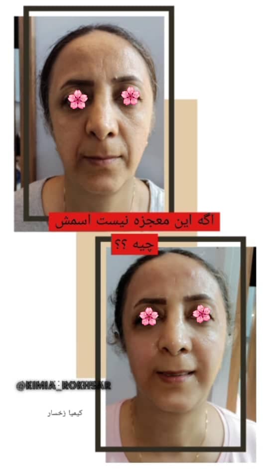 کلینیک زیبایی پوست و مو کیمیا رخسار در سمنان