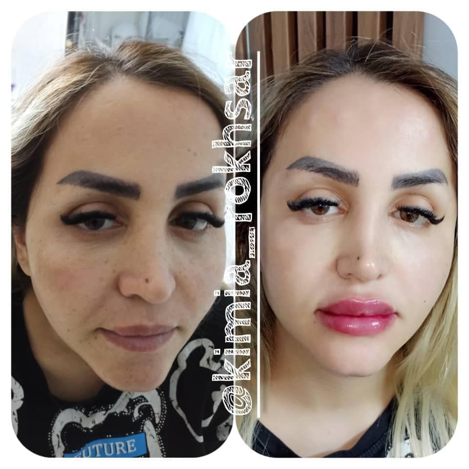 کلینیک زیبایی پوست و مو کیمیا رخسار در سمنان