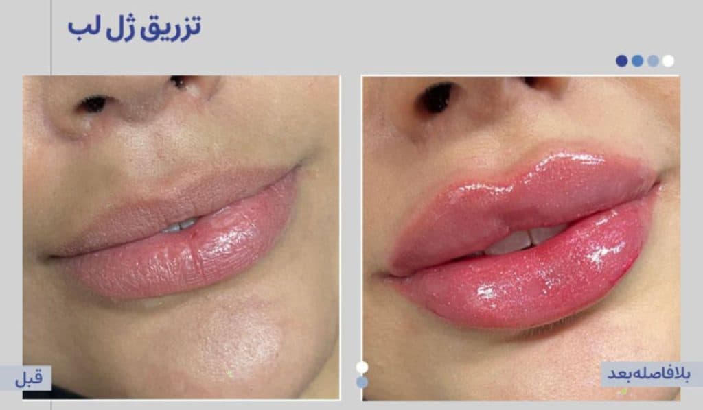 کلینیک زیبایی آنیل در مصطفی خمینی بندرعباس