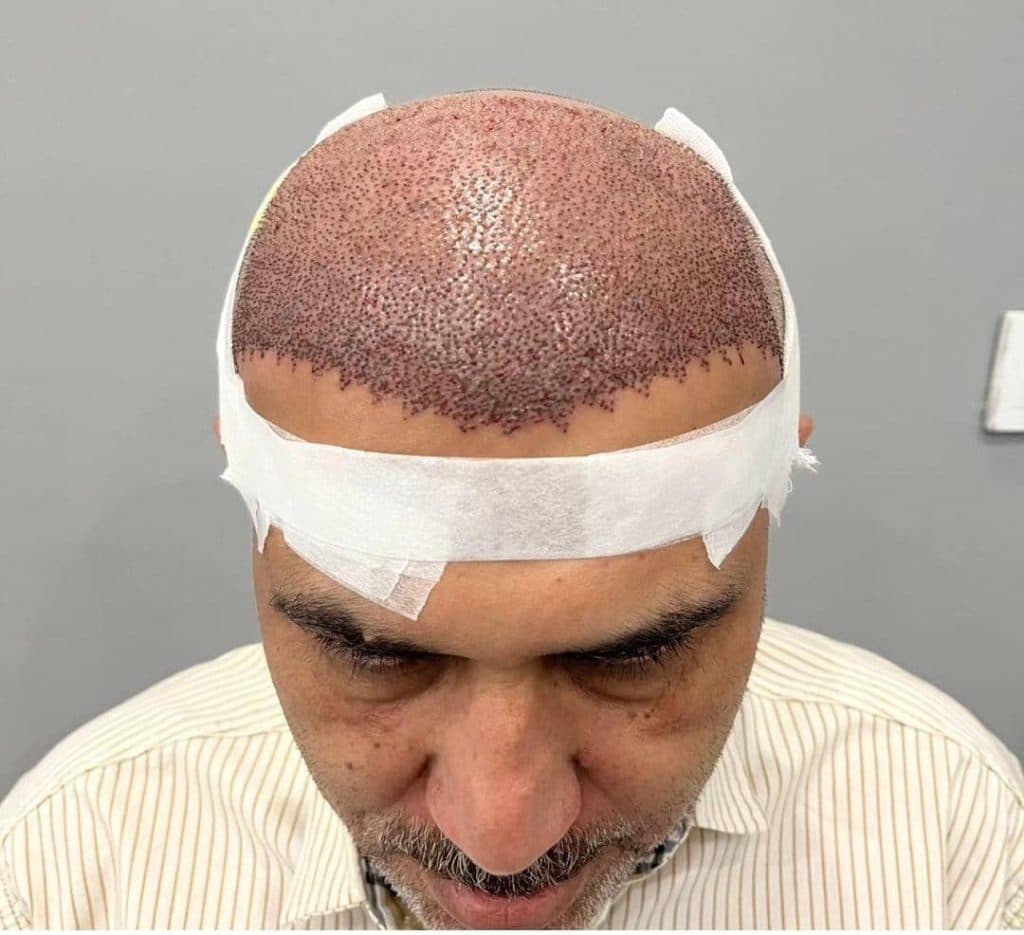 کلینیک تخصصی کاشت مو فاطمه بهداروند در شوشتر