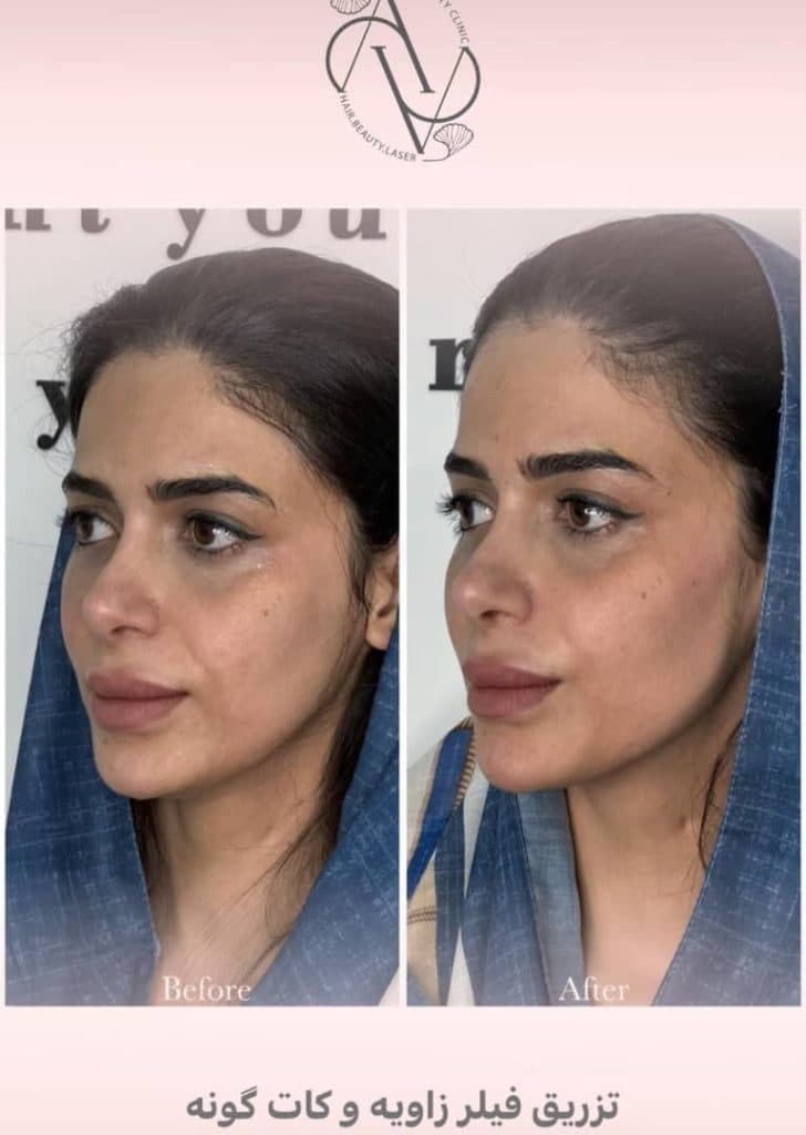 کلینیک زیبایی کاشت مو اویسا در شیراز
