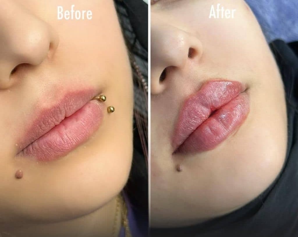 کلینیک زیبایی کاشت مو اویسا در شیراز