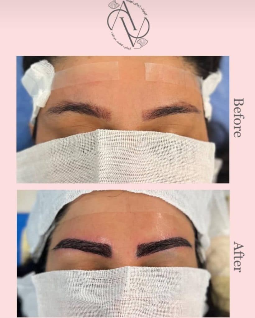 کلینیک زیبایی کاشت مو اویسا در شیراز