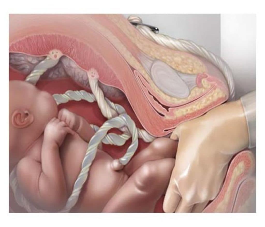 مطب فوق تخصصی زنان دکتر معصومه شفاعت در چهارراه طالقانی کرج