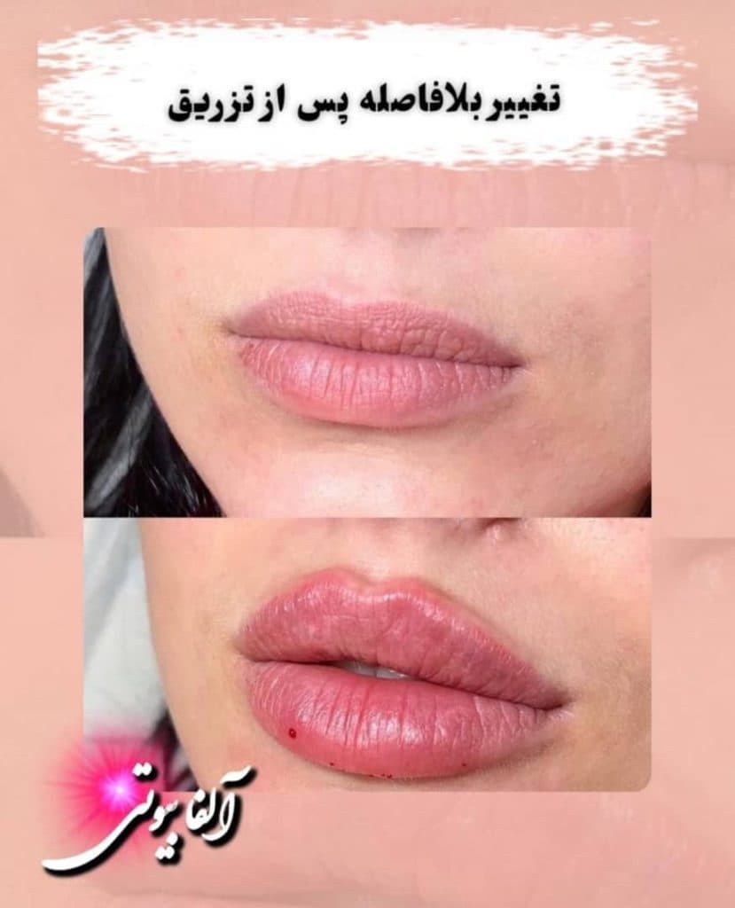 کلینیک زیبایی لیزر آلفا در مریوان