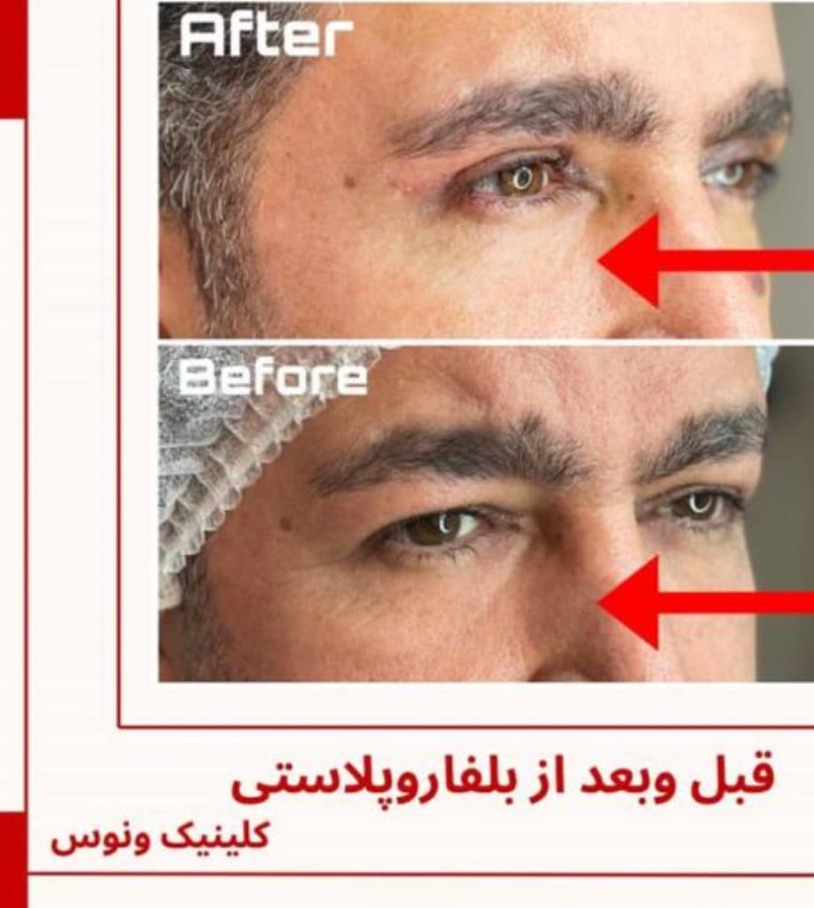 کلینیک زیبایی ونوس در مشیریه تهران