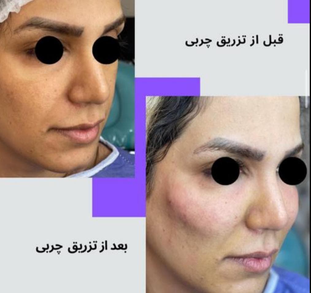 کلینیک زیبایی ونوس در مشیریه تهران