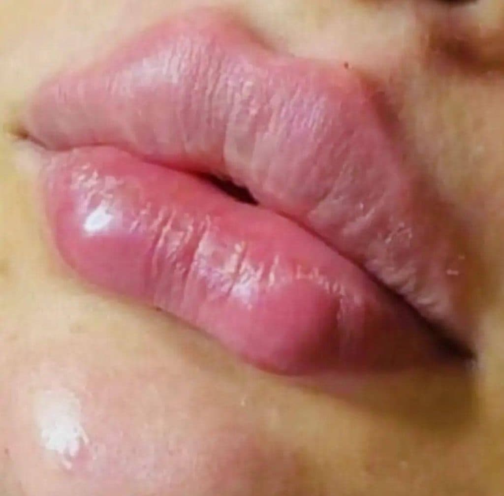 کلینیک تخصصی زیبایی پوست و مو سوگند در قائمشهر