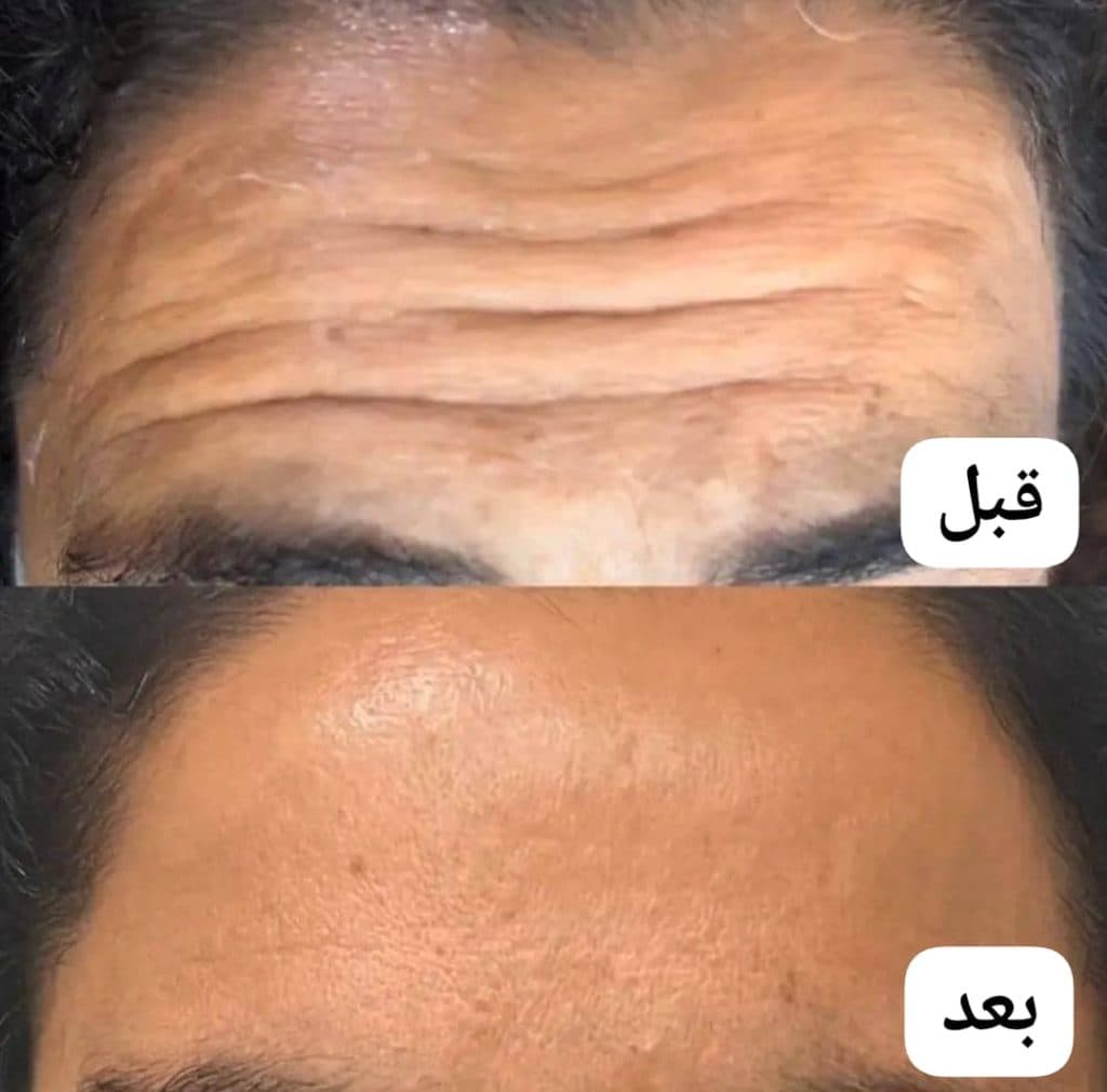 کلینیک تخصصی زیبایی پوست و مو سوگند در قائمشهر