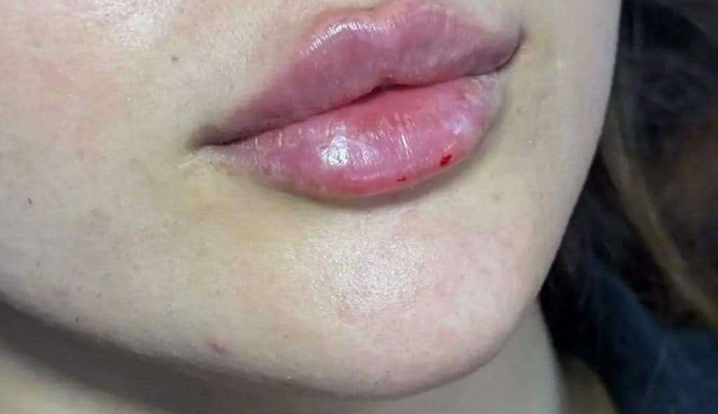 کلینیک تخصصی زیبایی پوست و مو سوگند در قائمشهر