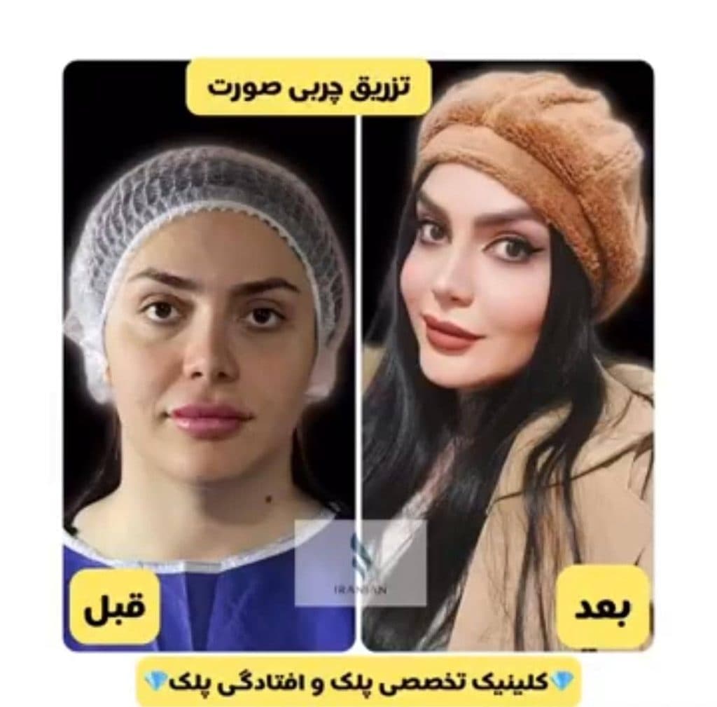 کلینیک تخصصی جراحی پلک ایرانیان در تهران