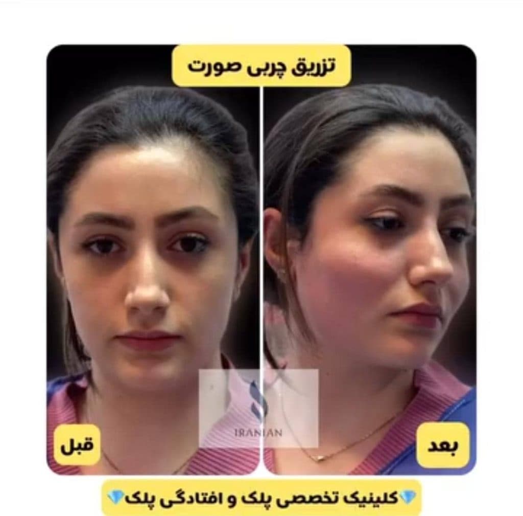 کلینیک تخصصی جراحی پلک ایرانیان در تهران