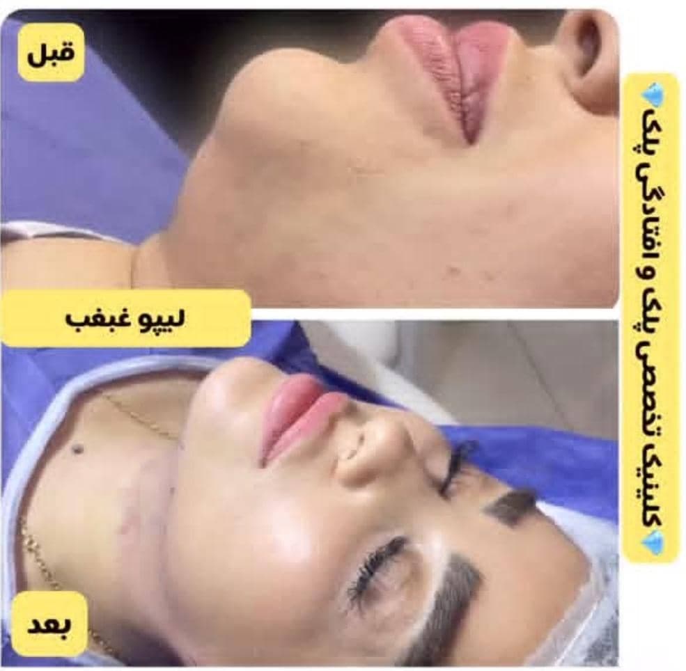 کلینیک تخصصی جراحی پلک ایرانیان در تهران
