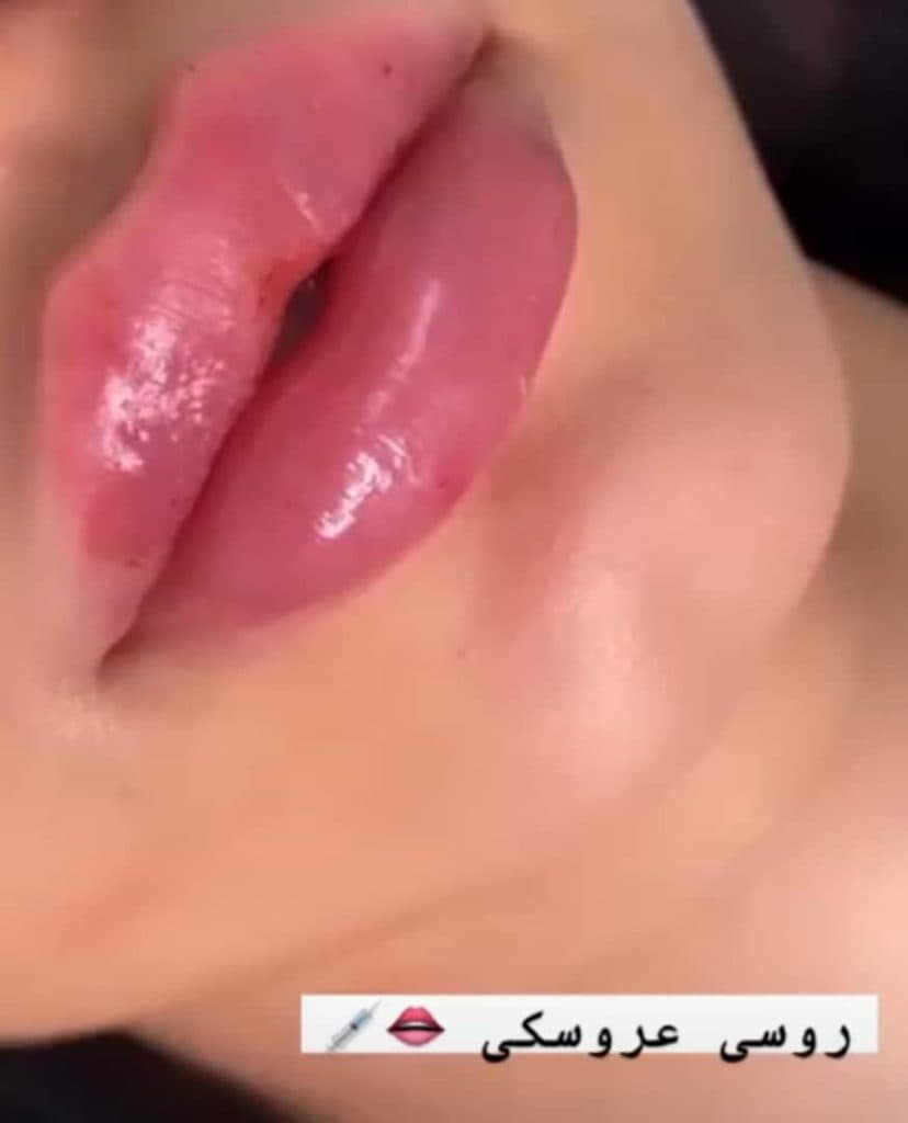 مرکز تخصصی ژل و بوتاکس امیری در کرمانشاه