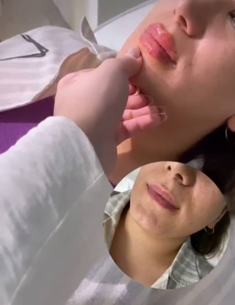 مرکز تخصصی ژل و بوتاکس امیری در کرمانشاه