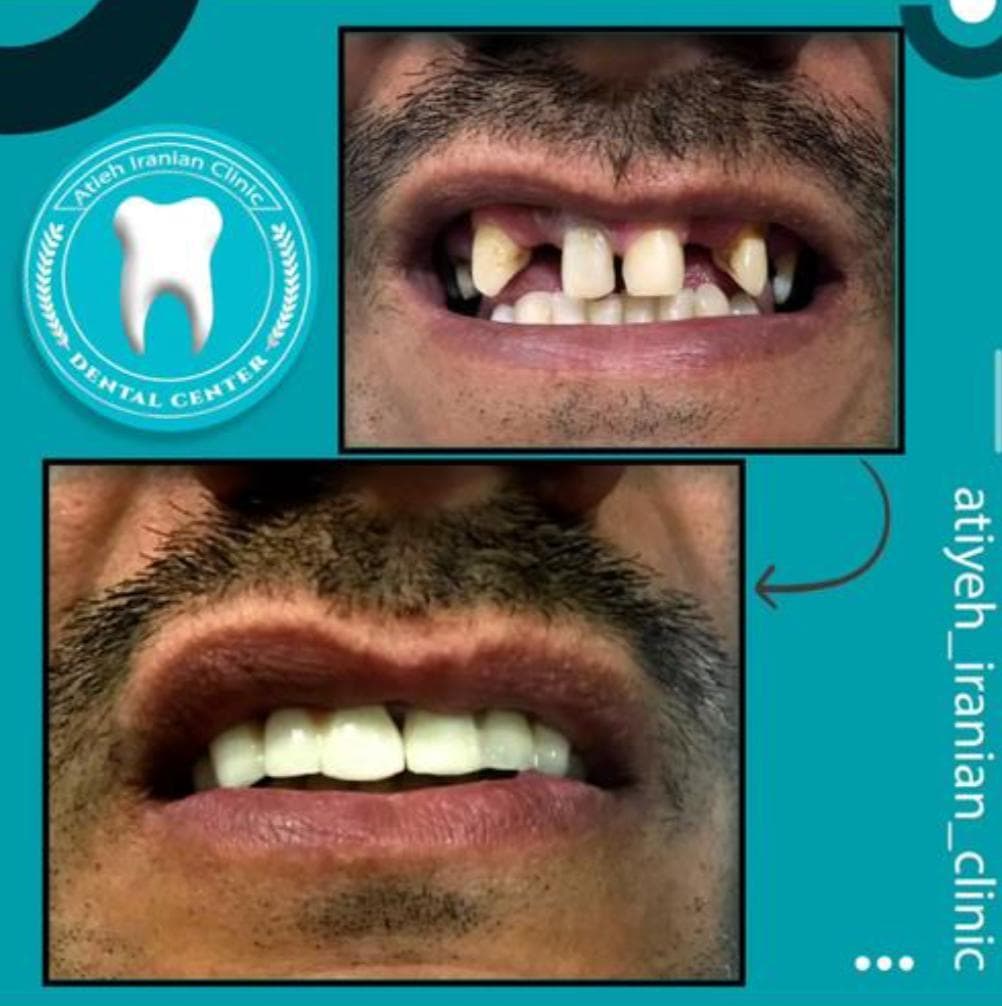 کلینیک دندانپزشکی آتیه ایرانیان در پنج آذر اصفهان