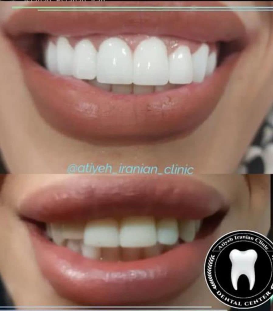 کلینیک دندانپزشکی آتیه ایرانیان در پنج آذر اصفهان