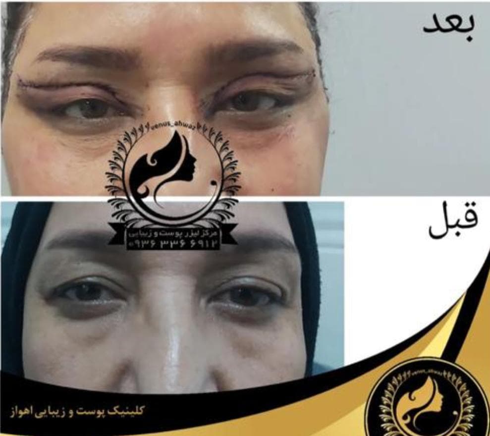 مرکز لیزر ونوس در نادری اهواز