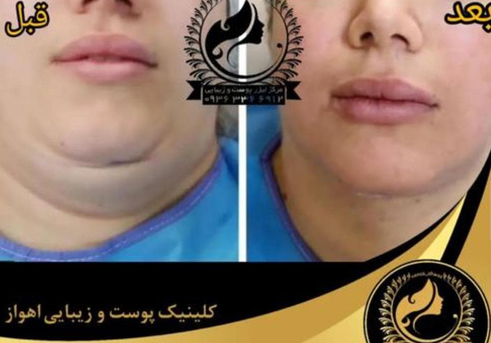 مرکز لیزر ونوس در نادری اهواز