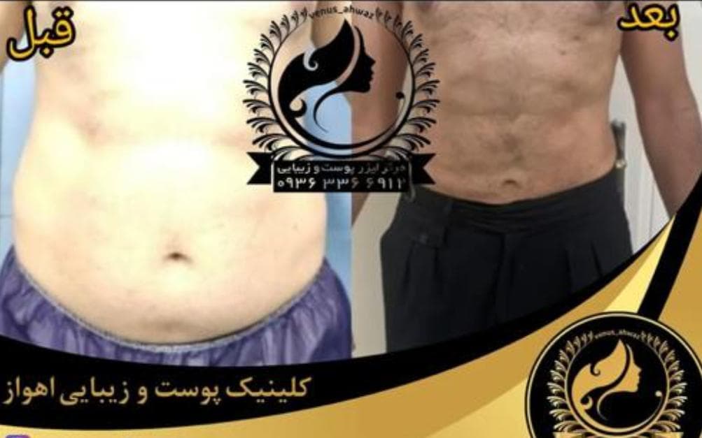 مرکز لیزر ونوس در نادری اهواز