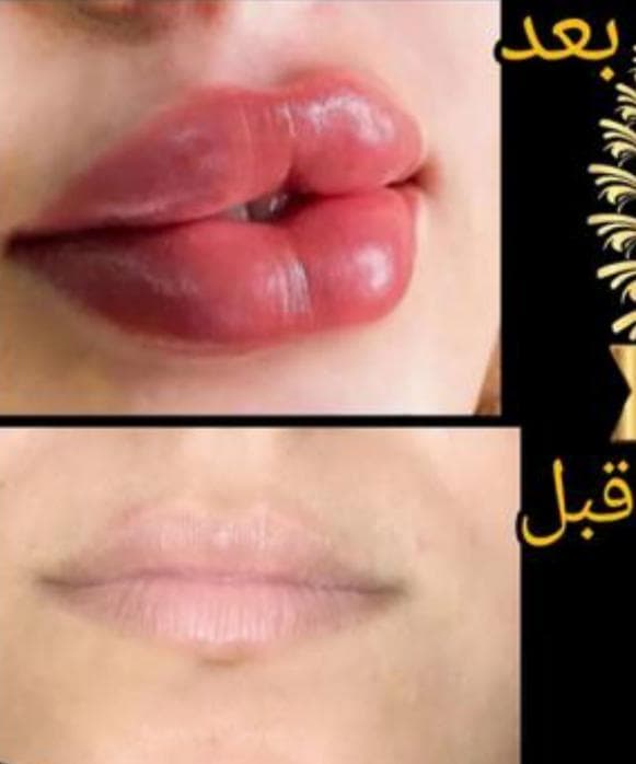 مرکز لیزر ونوس در نادری اهواز