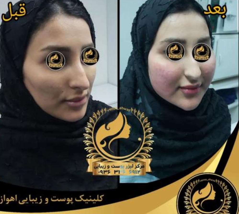 مرکز لیزر ونوس در نادری اهواز