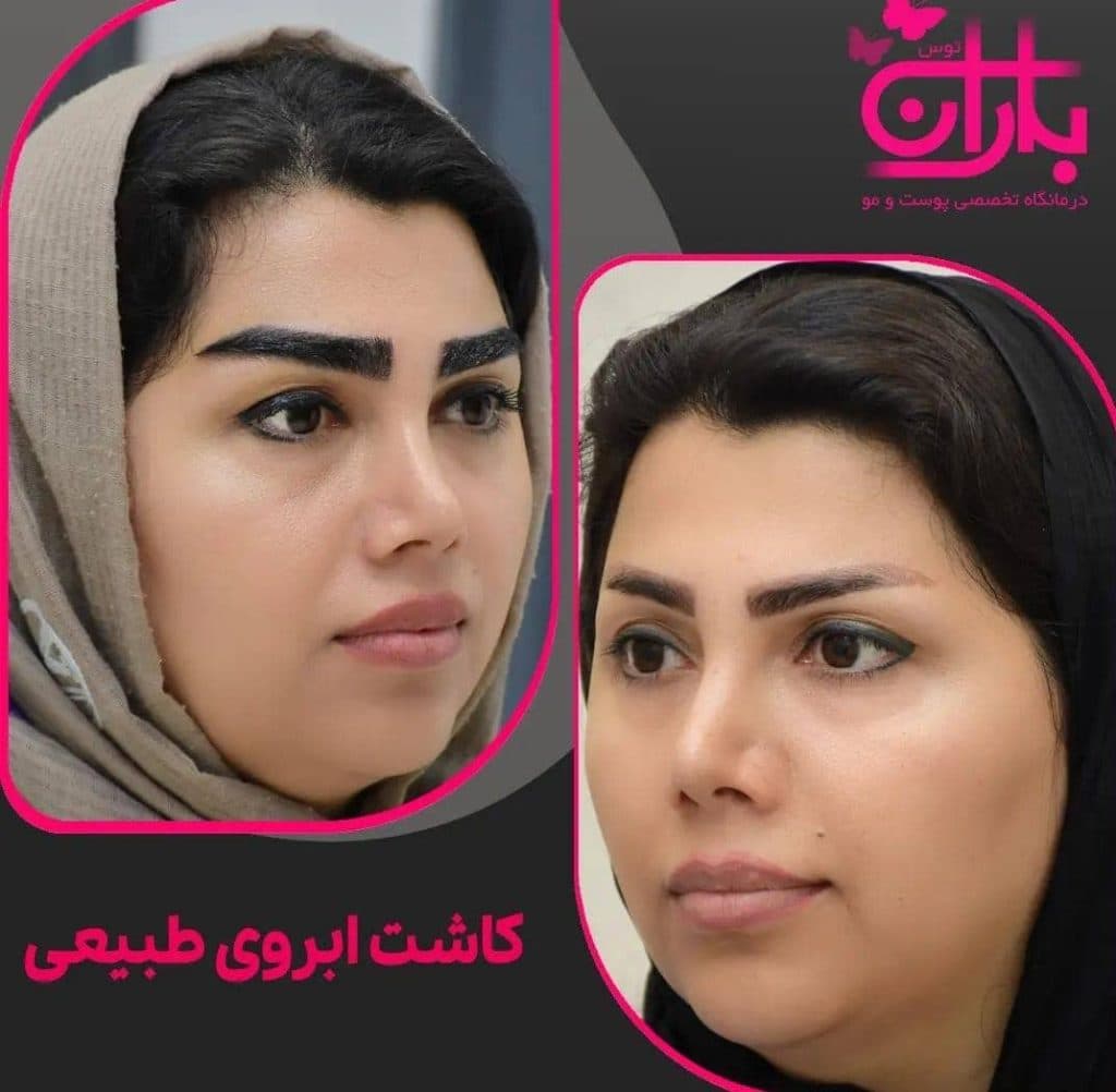 کلینیک پوست و مو باران توس در مشهد