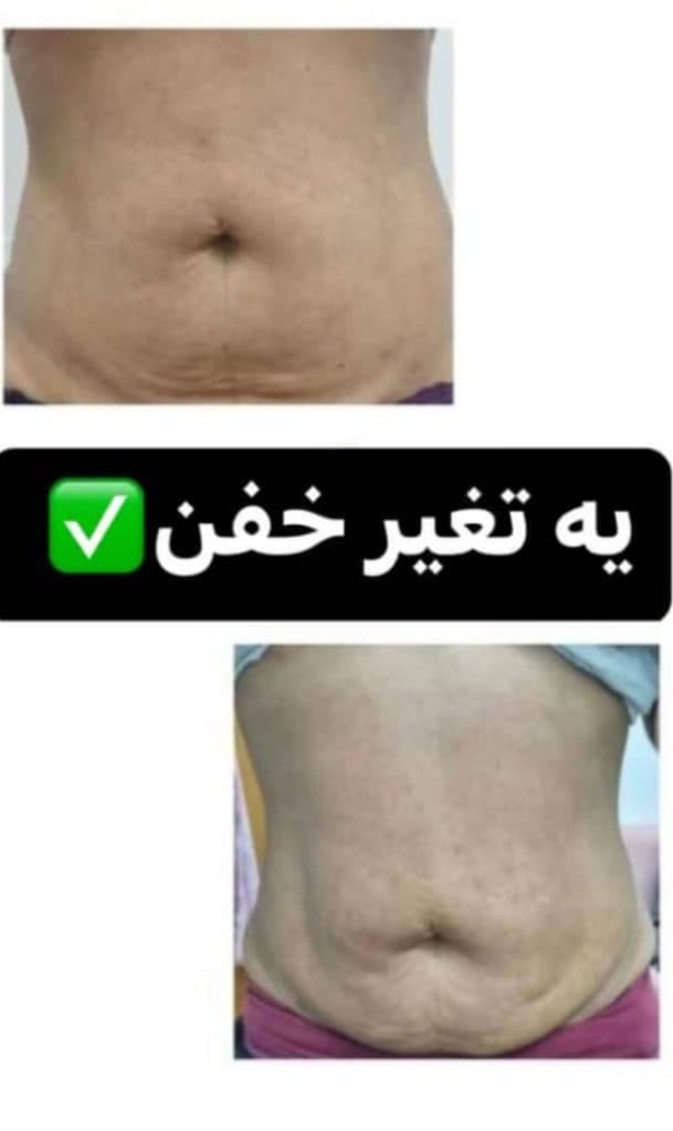 مرکز لاغری و تناسب اندام الهام سبک پا در قم