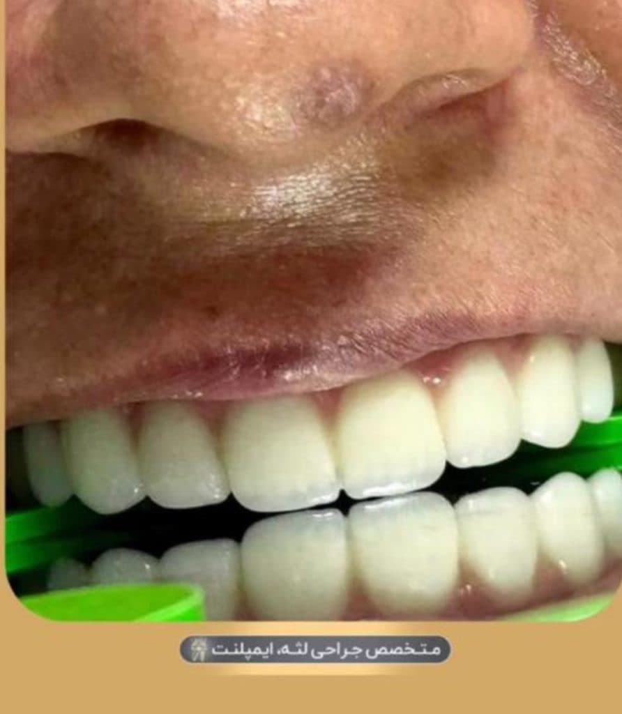 مرکز تخصصی ایمپلنت دندان دکتر شهرزاد شاه بیک در پاسداران تهران