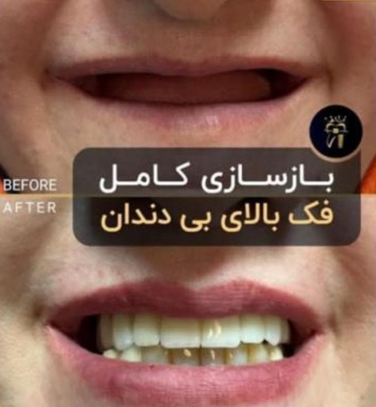 مرکز تخصصی ایمپلنت دندان دکتر شهرزاد شاه بیک در پاسداران تهران