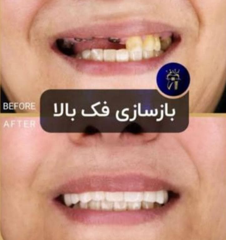 مرکز تخصصی ایمپلنت دندان دکتر شهرزاد شاه بیک در پاسداران تهران